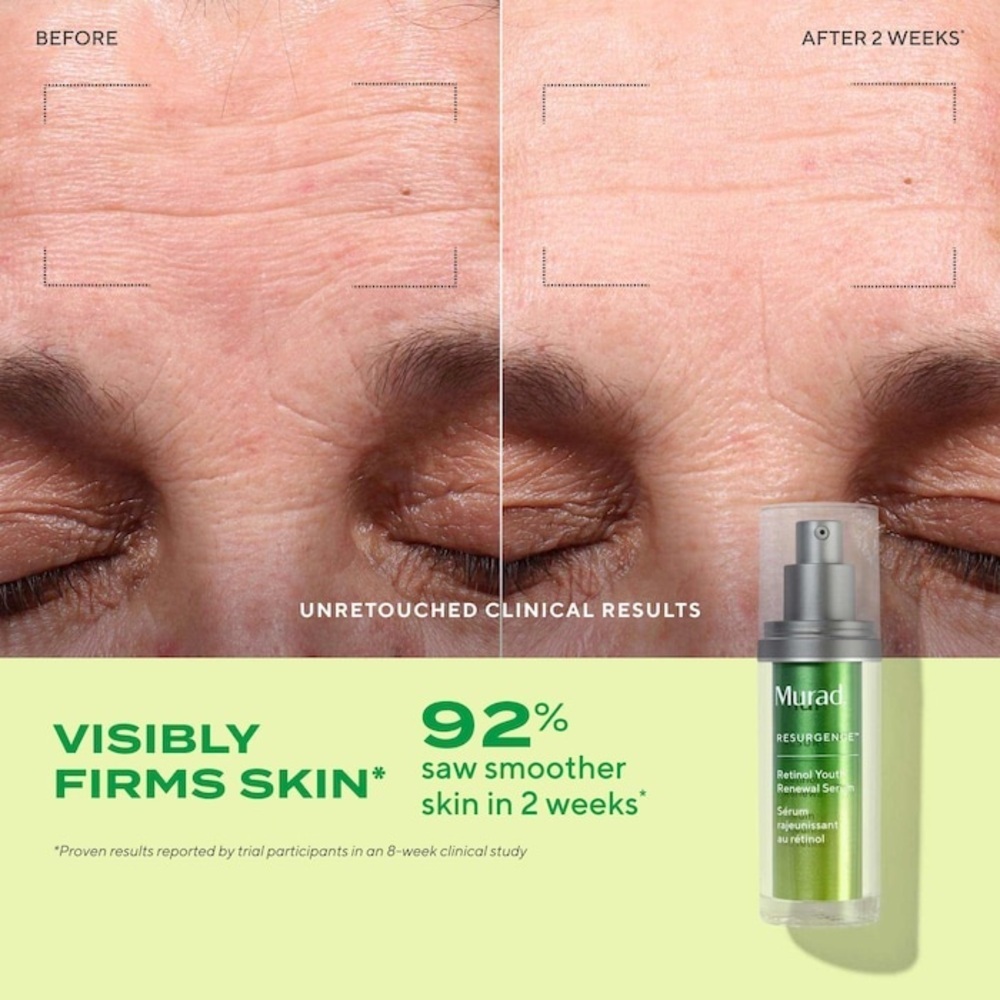 Murad 
Retinol Youth Renewal Serum - Picture 4 of 6